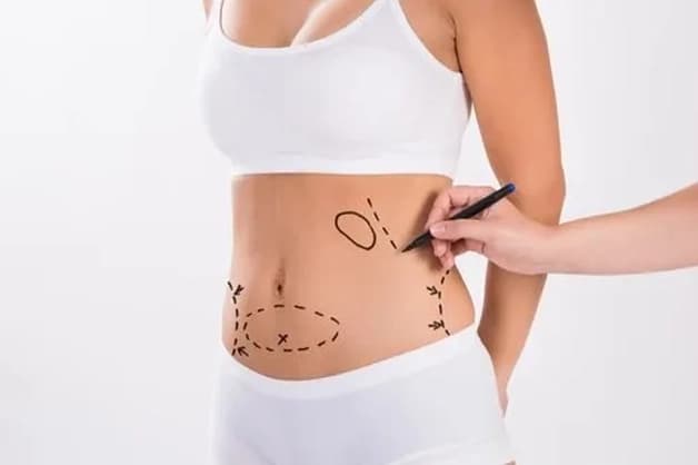 About Body Surgeries