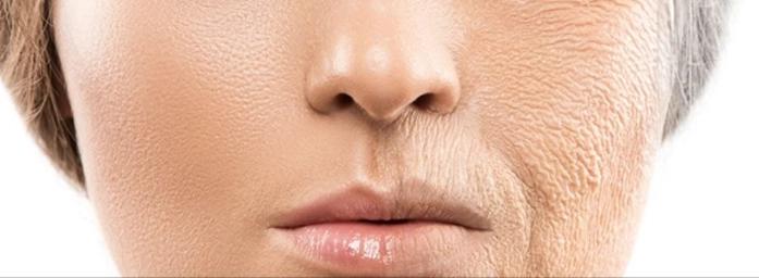 Skin aging
