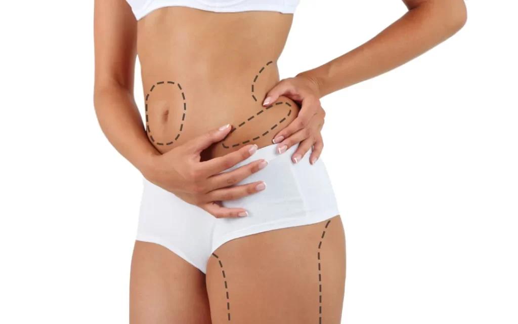 Body Contouring VS Body Sculpting