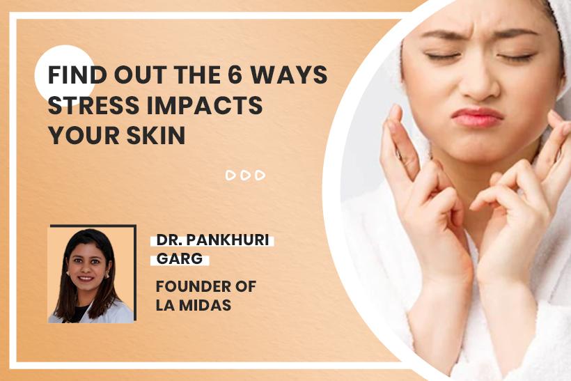 Find Out The 6 Ways Stress Impacts Your Skin