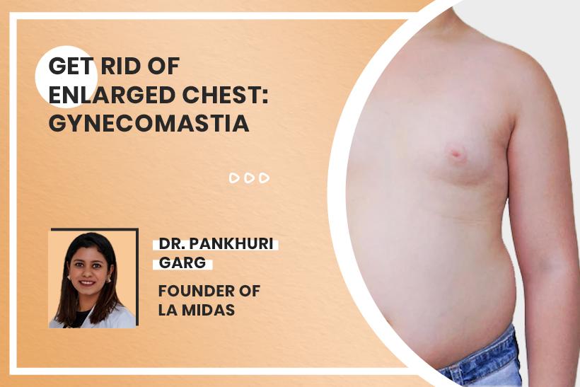 Get Rid Of Enlarged Chest: Gynecomastia