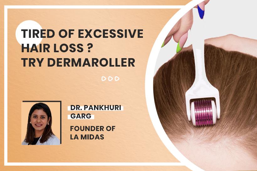 Tired Of Excessive Hair Loss? Try Dermaroller