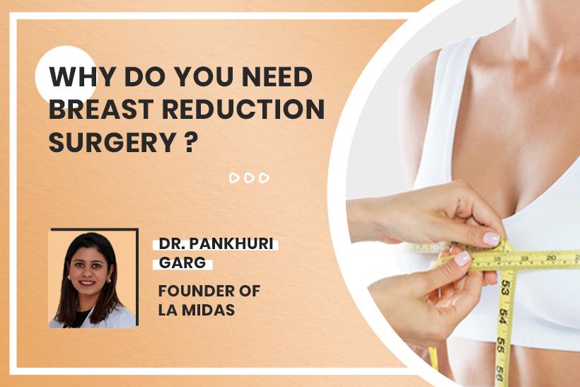 Why Do You Need Breast Reduction Surgery?